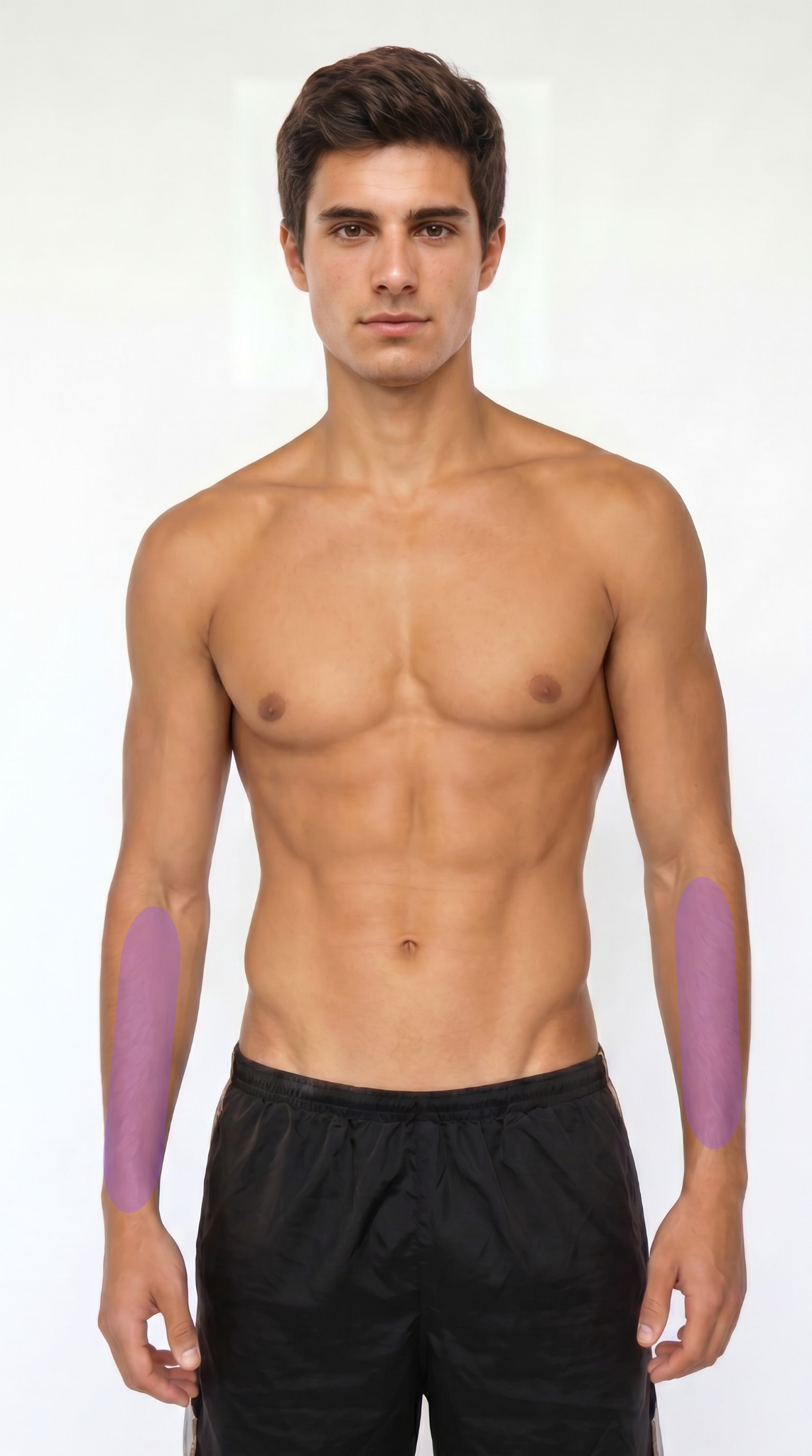 Medio brazo (M) - 6 Sesiones